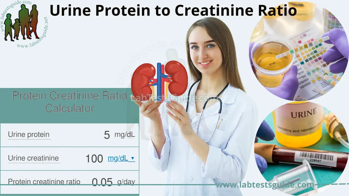 Urine Protein To Creatinine Ratio Test Purpose Procedure And Results A Comprehensive Guide