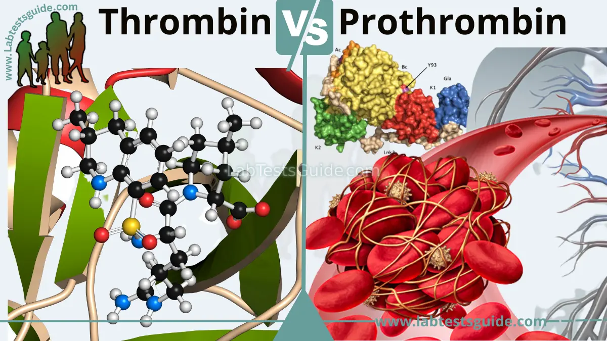 differences-between-thrombin-and-prothrombin-lab-tests-guide