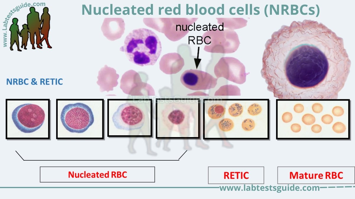 Nucleated red blood cells (NRBCs) | Lab Tests Guide