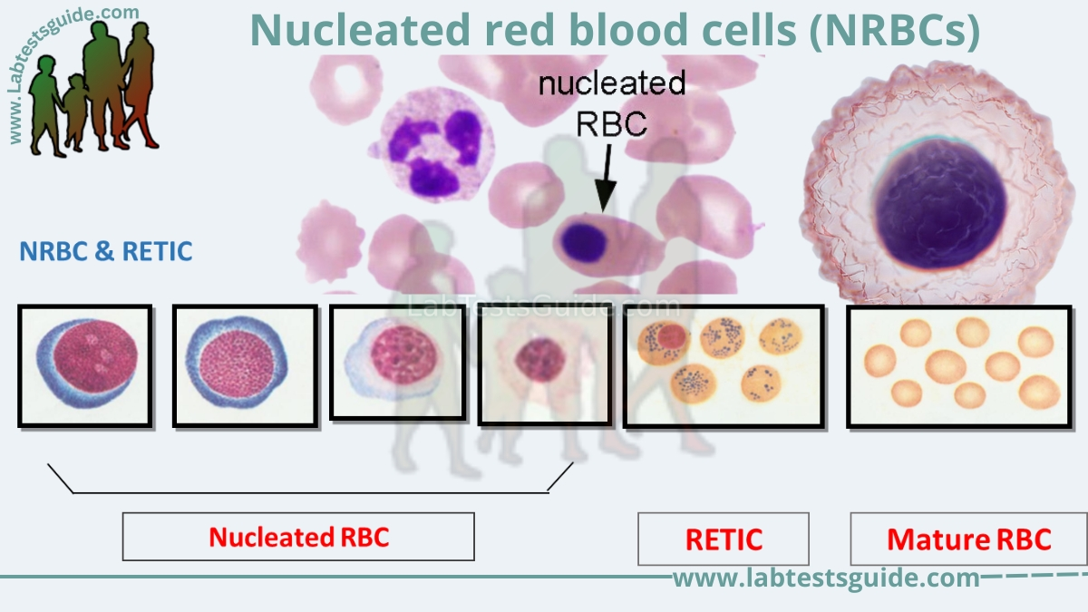 Nucleated Red Blood Cells Vs Lymphocyte