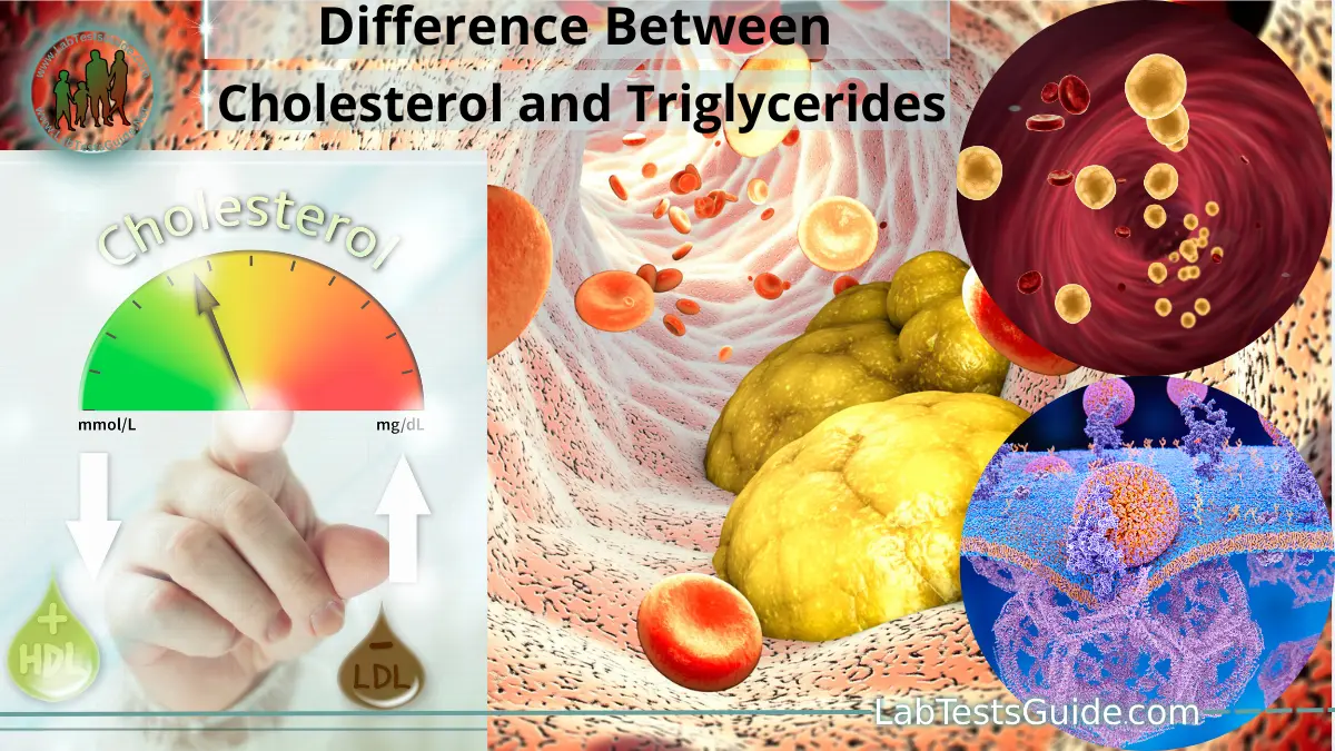 Differences Between Cholesterol and Triglycerides | Lab Tests Guide