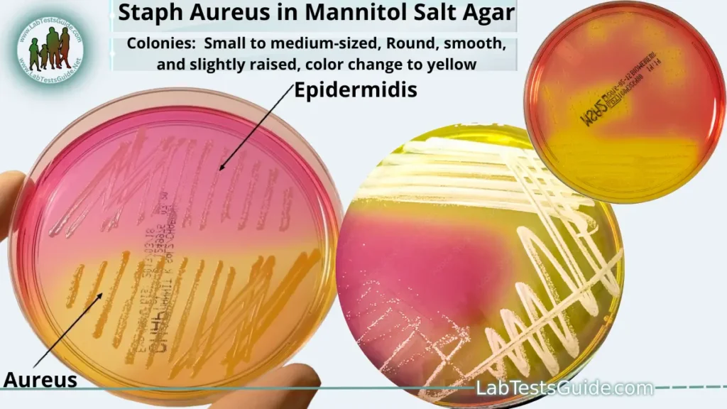 Staphylococcus Aureus in Mannitol Salt Agar