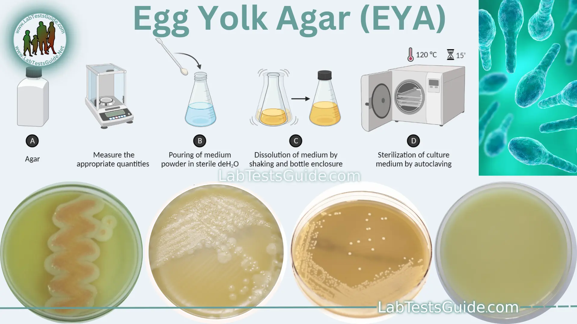 egg-yolk-agar-purpose-procedure-composition-results-and-more