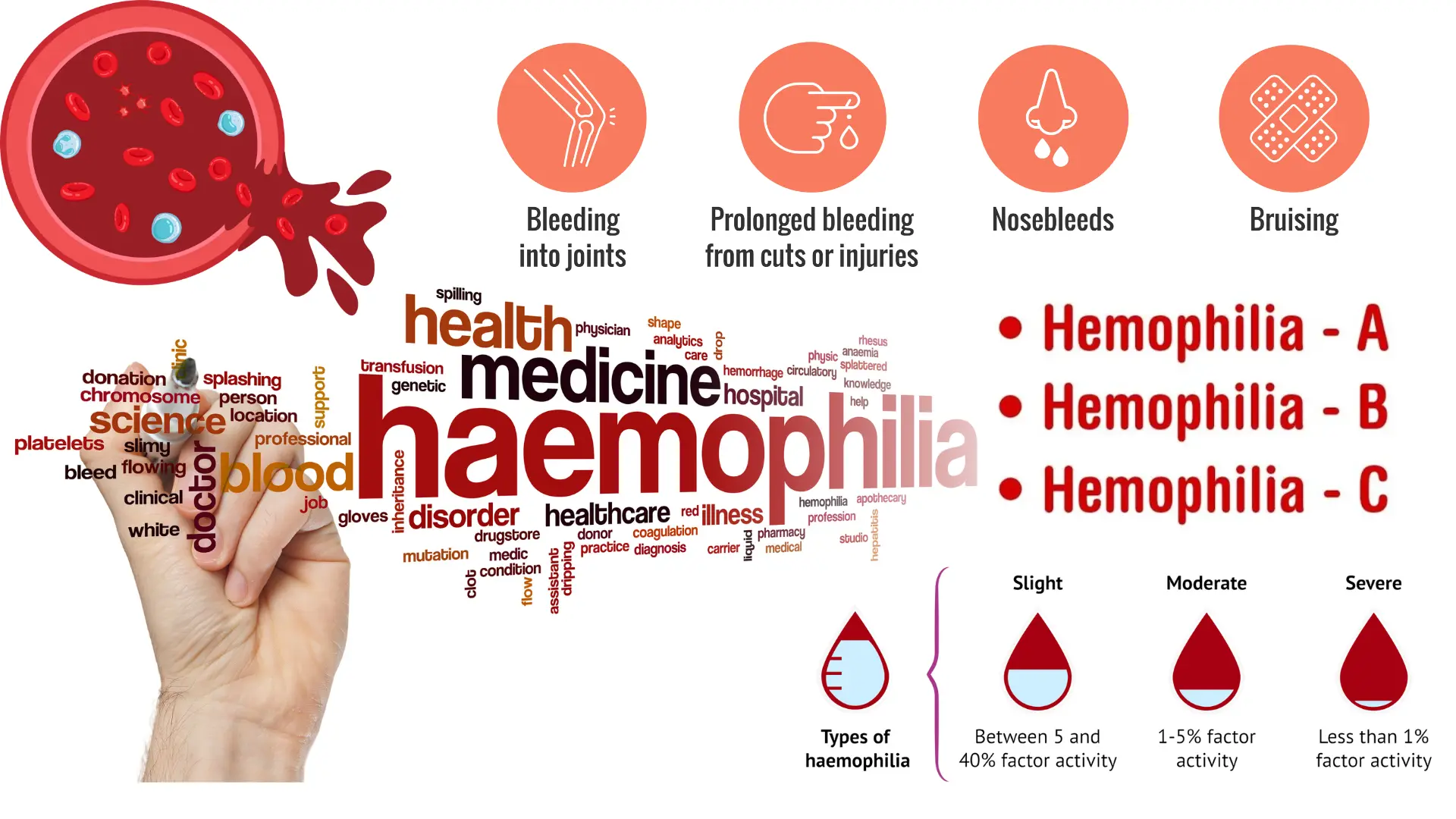 Hemophilia